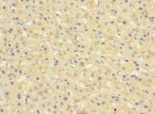 KIAA1161 Antibody - Immunohistochemistry of paraffin-embedded human adrenal gland tissue using KIAA1161 Antibody at dilution of 1:100