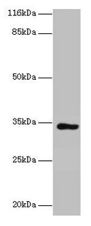 KIAA1191 Antibody - Western blot All lanes: KIAA1191 antibody at 2µg/ml + Mouse heart tissue Secondary Goat polyclonal to rabbit IgG at 1/10000 dilution Predicted band size: 34, 32, 11 kDa Observed band size: 34 kDa