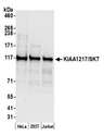KIAA1217 Antibody - Detection of human KIAA1217/SKT by western blot. Samples: Whole cell lysate (50 µg) from HeLa, HEK293T, and Jurkat cells prepared using NETN lysis buffer. Antibody: Affinity purified rabbit anti-KIAA1217/SKT antibody used for WB at 0.1 µg/ml. Detection: Chemiluminescence with an exposure time of 30 seconds.