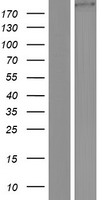 KIAA1217 Protein - Western validation with an anti-DDK antibody * L: Control HEK293 lysate R: Over-expression lysate