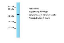 KIAA1257 Antibody -  This image was taken for the unconjugated form of this product. Other forms have not been tested.
