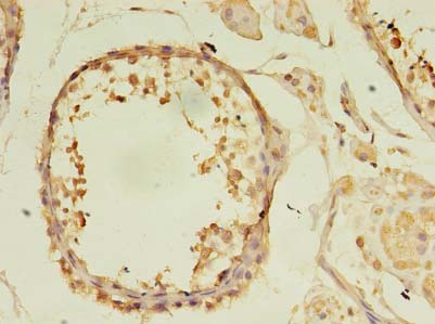 KIAA1257 Antibody - Immunohistochemistry of paraffin-embedded human testis tissue using antibody at dilution of 1:100.