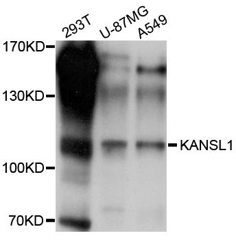 KIAA1267 Antibody - Western blot analysis of extracts of various cell lines, using KANSL1 antibody at 1:1000 dilution. The secondary antibody used was an HRP Goat Anti-Rabbit IgG (H+L) at 1:10000 dilution. Lysates were loaded 25ug per lane and 3% nonfat dry milk in TBST was used for blocking. An ECL Kit was used for detection and the exposure time was 10s.