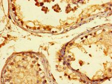 KIAA1267 Antibody - Immunohistochemistry of paraffin-embedded human testis tissue at dilution of 1:100