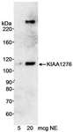 KIAA1276 / FAM184B Antibody - Detection of Human KIAA1276 by Western Blot. Samples: Nuclear extract (5 and 20 ug) from HeLa cells. Antibody: Affinity purified rabbit anti-KIAA1276 antibody used at 0.2 ug/ml. Detection: Chemiluminescence with an exposure time of 20 minutes.