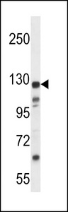 KIAA1324 / maba1 Antibody - K1324 Antibody western blot of MDA-MB435 cell line lysates (35 ug/lane). The K1324 antibody detected the K1324 protein (arrow).