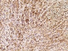 KIAA1344 / TXNDC16 Antibody - Immunochemical staining of human TXNDC16 in human adrenal gland with rabbit polyclonal antibody at 1:100 dilution, formalin-fixed paraffin embedded sections.