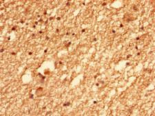 KIAA1377 Antibody - Immunohistochemistry of paraffin-embedded human brain tissue using CEP126 Antibody at dilution of 1:100