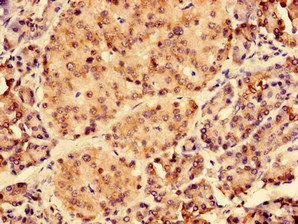 KIAA1377 Antibody - Immunohistochemistry of paraffin-embedded human pancreatic tissue using CEP126 Antibody at dilution of 1:100