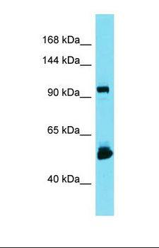 KIAA1429 Antibody - Western blot of U937. LRRC14B antibody dilution 1.0 ug/ml.  This image was taken for the unconjugated form of this product. Other forms have not been tested.