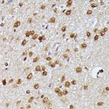 KIAA1429 Antibody - Immunohistochemistry of paraffin-embedded Rat brain using KIAA1429 Polyclonal Antibody at dilution of 1:100 (40x lens).