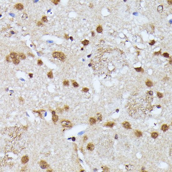 KIAA1429 Antibody - Immunohistochemistry of paraffin-embedded Mouse brain using KIAA1429 Polyclonal Antibody at dilution of 1:100 (40x lens).