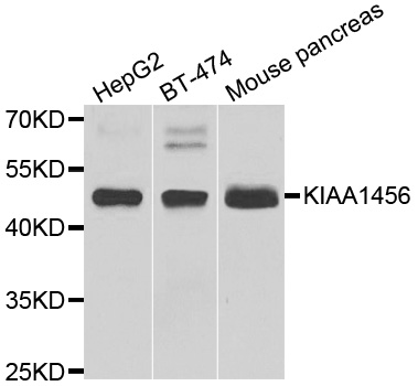 KIAA1456 / C8orf79 Antibody - Western blot analysis of extracts of various cell lines.
