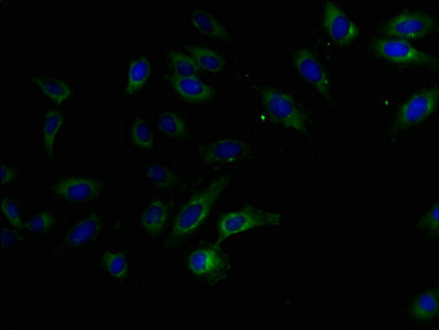 KIAA1467 Antibody - Immunofluorescent analysis of Hela cells using FAM234B Antibody at dilution of 1:100 and Alexa Fluor 488-congugated AffiniPure Goat Anti-Rabbit IgG(H+L)