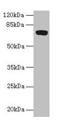 KIAA1467 Antibody - Western blot All lanes: KIAA1467 antibody at 6µg/ml + Human placenta tissue Secondary Goat polyclonal to rabbit IgG at 1/10000 dilution Predicted band size: 67 kDa Observed band size: 67 kDa