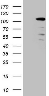 KIAA1524 / p90 Autoantigen Antibody - HEK293T cells were transfected with the pCMV6-ENTRY control (Left lane) or pCMV6-ENTRY KIAA1524 (Right lane) cDNA for 48 hrs and lysed. Equivalent amounts of cell lysates (5 ug per lane) were separated by SDS-PAGE and immunoblotted with anti-KIAA1524 (1:2000).