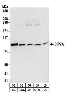 KIAA1524 / p90 Autoantigen Antibody - Detection of Mouse and Rat CIP2A by Western Blot. Samples: Whole cell lysate (50 ug) from NIH3T3, TCMK-1, 4T1, CT26.WT, and rat C6 cells. Antibodies: Affinity purified rabbit anti-CIP2A antibody used for WB at 0.4 ug/ml. Detection: Chemiluminescence with an exposure time of 30 seconds.