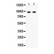 KIAA1524 / p90 Autoantigen Antibody - KIAA1524 antibody Western blot. All lanes: Anti KIAA1524 at 0.5 ug/ml. Lane 1: Mouse Testis Tissue Lysate at 50 ug. Lane 2: HELA Whole Cell Lysate at 40 ug. Predicted band size: 90 kD. Observed band size: 90 kD.