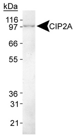 KIAA1524 / p90 Autoantigen Antibody - Detection of CIP2A in HeLa whole cell lysate.  This image was taken for the unconjugated form of this product. Other forms have not been tested.