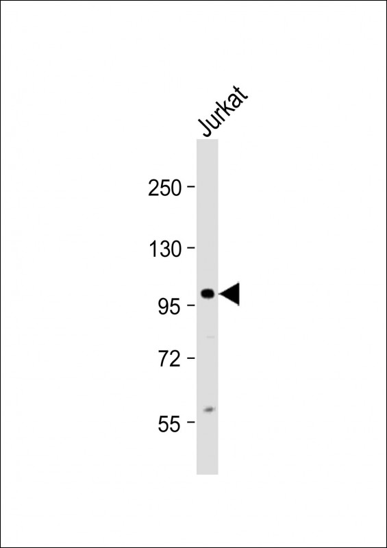 KIAA1524 / p90 Autoantigen Antibody - Anti-KIAA1524 Antibody (Center) at 1:2000 dilution + Jurkat whole cell lysate Lysates/proteins at 20 µg per lane. Secondary Goat Anti-Rabbit IgG, (H+L), Peroxidase conjugated at 1/10000 dilution. Predicted band size: 102 kDa Blocking/Dilution buffer: 5% NFDM/TBST.