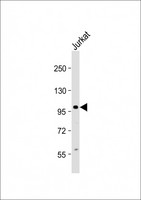 KIAA1524 / p90 Autoantigen Antibody - Anti-KIAA1524 Antibody (Center) at 1:2000 dilution + Jurkat whole cell lysate Lysates/proteins at 20 µg per lane. Secondary Goat Anti-Rabbit IgG, (H+L), Peroxidase conjugated at 1/10000 dilution. Predicted band size: 102 kDa Blocking/Dilution buffer: 5% NFDM/TBST.