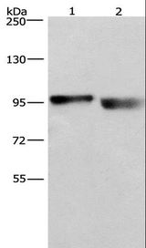 KIAA1524 / p90 Autoantigen Antibody - Western blot analysis of A431 and LOVO cell, using KIAA1524 Polyclonal Antibody at dilution of 1:597.