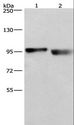 KIAA1524 / p90 Autoantigen Antibody - Western blot analysis of A431 and LOVO cell, using KIAA1524 Polyclonal Antibody at dilution of 1:597.