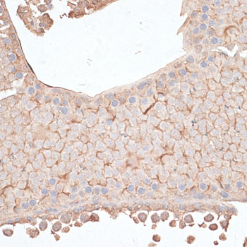 KIAA1524 / p90 Autoantigen Antibody - Immunohistochemistry of paraffin-embedded mouse testis using KIAA1524 antibody at dilution of 1:100 (40x lens).