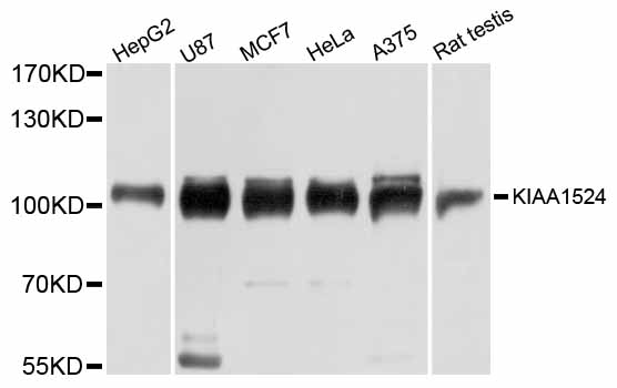 KIAA1524 / p90 Autoantigen Antibody - Western blot analysis of extracts of various cell lines, using KIAA1524 antibody at 1:3000 dilution. The secondary antibody used was an HRP Goat Anti-Rabbit IgG (H+L) at 1:10000 dilution. Lysates were loaded 25ug per lane and 3% nonfat dry milk in TBST was used for blocking. An ECL Kit was used for detection and the exposure time was 10s.