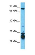 KIAA1530 Antibody - Western blot of UVSSA Antibody with human Lymph Node Tumor lysate.  This image was taken for the unconjugated form of this product. Other forms have not been tested.