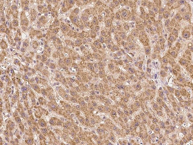 KIAA1530 Antibody - Immunochemical staining of human UVSSA in human liver with rabbit polyclonal antibody at 1:300 dilution, formalin-fixed paraffin embedded sections.