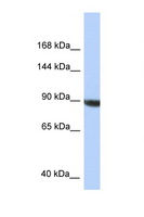 KIAA1549 Antibody - KIAA1549 antibody Western blot of HepG2 Cell lysate. Antibody concentration 1 ug/ml.  This image was taken for the unconjugated form of this product. Other forms have not been tested.