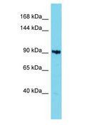 KIAA1614 Antibody - KIAA1614 antibody Western Blot of 721_B. Antibody dilution: 1 ug/ml.  This image was taken for the unconjugated form of this product. Other forms have not been tested.