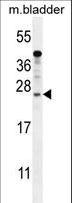 KIAA1644 Antibody - KIAA1644 Antibody western blot of mouse bladder tissue lysates (35 ug/lane). The KIAA1644 antibody detected the KIAA1644 protein (arrow).