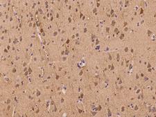 KIAA1674 / LRRC27 Antibody - Immunochemical staining of human LRRC27 in human brain with rabbit polyclonal antibody at 1:100 dilution, formalin-fixed paraffin embedded sections.