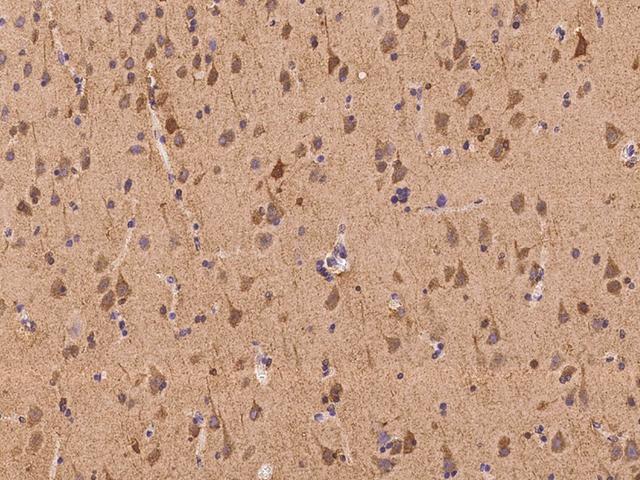 KIAA1674 / LRRC27 Antibody - Immunochemical staining of human LRRC27 in human brain with rabbit polyclonal antibody at 1:100 dilution, formalin-fixed paraffin embedded sections.