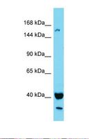 KIAA1683 Antibody - Western blot of Human MCF9. KIAA1683 antibody dilution 1.0 ug/ml.  This image was taken for the unconjugated form of this product. Other forms have not been tested.