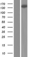KIAA1755 Protein - Western validation with an anti-DDK antibody * L: Control HEK293 lysate R: Over-expression lysate