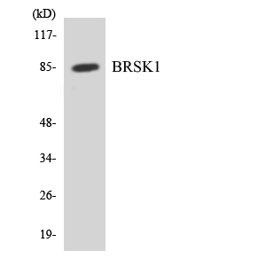 KIAA1811 / BRSK1 Antibody - Western blot analysis of the lysates from COLO205 cells using BRSK1 antibody.
