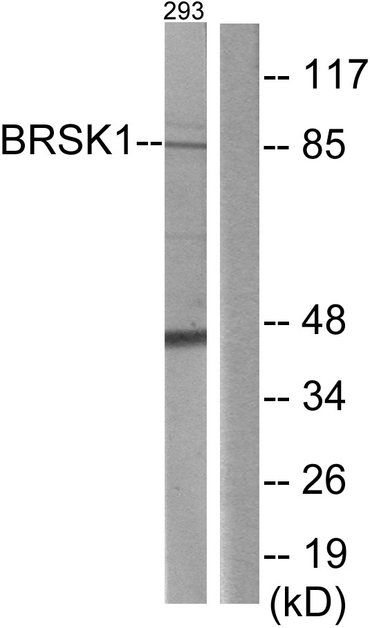 KIAA1811 / BRSK1 Antibody - Western blot analysis of lysates from 293 cells, using BRSK1 Antibody. The lane on the right is blocked with the synthesized peptide.