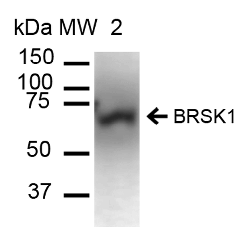 KIAA1811 / BRSK1 Antibody - Immunohistochemistry analysis using Rabbit Anti-BRSK1 Polyclonal Antibody. Tissue: Brain. Species: Human. Fixation: Formalin Fixed Paraffin-Embedded. Primary Antibody: Rabbit Anti-BRSK1 Polyclonal Antibody  at 1:50 for 30 min at RT. Counterstain: Hematoxylin. Magnification: 10X.