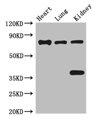 KIAA1811 / BRSK1 Antibody - Positive WB detected in:Mouse heart tissue,Mouse lung tissue,Mouse kidney tissue;All lanes:BRSK1 antibody at 3.5ug/ml;Secondary;Goat polyclonal to rabbit IgG at 1/50000 dilution;Predicted band size: 86,87,39 kDa;Observed band size: 86,39 kDa;