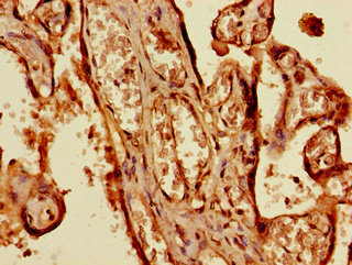 KIAA1811 / BRSK1 Antibody - Immunohistochemistry of paraffin-embedded human placenta tissue using BRSK1 Antibody at dilution of 1:100