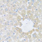 KIAA1811 / BRSK1 Antibody - Immunohistochemistry of paraffin-embedded Rat liver using BRSK1 Polyclonal Antibody at dilution of 1:100 (40x lens).