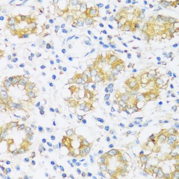 KIAA1811 / BRSK1 Antibody - Immunohistochemistry of paraffin-embedded Human stomach using BRSK1 Polyclonal Antibody at dilution of 1:100 (40x lens).