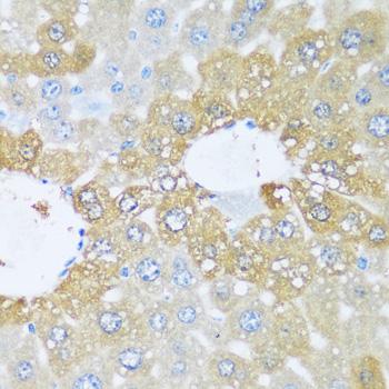 KIAA1811 / BRSK1 Antibody - Immunohistochemistry of paraffin-embedded Mouse liver using BRSK1 Polyclonal Antibody at dilution of 1:100 (40x lens).