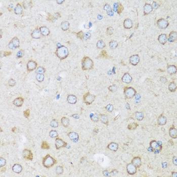 KIAA1811 / BRSK1 Antibody - Immunohistochemistry of paraffin-embedded Mouse brain using BRSK1 Polyclonal Antibody at dilution of 1:100 (40x lens).