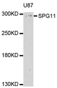 KIAA1840 / SPG11 Antibody - Western blot analysis of extracts of U-87MG cells, using SPG11 antibody at 1:1000 dilution. The secondary antibody used was an HRP Goat Anti-Rabbit IgG (H+L) at 1:10000 dilution. Lysates were loaded 25ug per lane and 3% nonfat dry milk in TBST was used for blocking. An ECL Kit was used for detection and the exposure time was 90s.