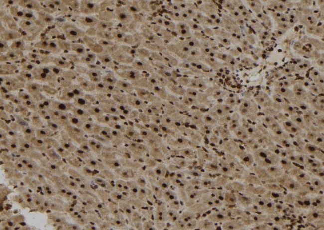 KIAA1840 / SPG11 Antibody - 1:100 staining mouse liver tissue by IHC-P. The sample was formaldehyde fixed and a heat mediated antigen retrieval step in citrate buffer was performed. The sample was then blocked and incubated with the antibody for 1.5 hours at 22°C. An HRP conjugated goat anti-rabbit antibody was used as the secondary.