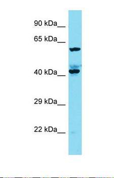 KIAA1841 Antibody - Western blot of Human A549. KIAA1841 antibody dilution 1.0 ug/ml.  This image was taken for the unconjugated form of this product. Other forms have not been tested.